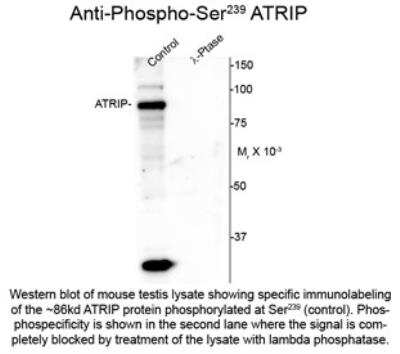 Western Blot: ATRIP [p Ser239] Antibody [NBP2-29537]